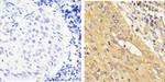 STAT1 Antibody in Immunohistochemistry (Paraffin) (IHC (P))