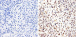 AKT1 Antibody in Immunohistochemistry (Paraffin) (IHC (P))