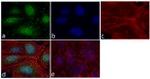 FAK Antibody in Immunocytochemistry (ICC/IF)