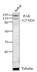 FAK Antibody in Western Blot (WB)