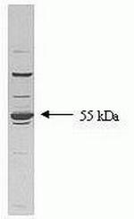 TGFBR1 Antibody in Western Blot (WB)