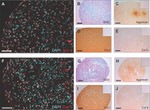 Aggrecan Antibody in Immunohistochemistry (IHC)