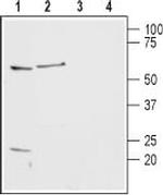 Histamine H2 Receptor (HRH2) (extracellular) Antibody in Western Blot (WB)