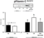 INSR beta Antibody in Western Blot (WB)