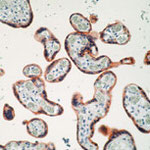 INSR beta Antibody in Immunohistochemistry (Paraffin) (IHC (P))