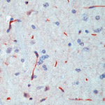 INSR beta Antibody in Immunohistochemistry (Paraffin) (IHC (P))