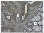 IGF1R alpha Antibody in Immunohistochemistry (IHC)