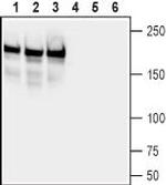 Neurofascin Antibody in Western Blot (WB)