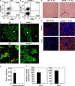 AIRE Antibody in Immunohistochemistry (IHC)