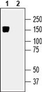 KCC2 (SLC12A5) Antibody in Western Blot (WB)