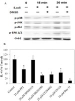 Phospho-AKT1 (Ser473) Antibody in Western Blot (WB)