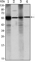 ALDH1A1 Antibody in Western Blot (WB)