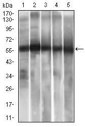 ALDH2 Antibody in Western Blot (WB)