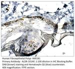 AKR1B1 Antibody in Immunohistochemistry (Paraffin) (IHC (P))