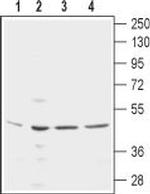 KCNN4 (KCa3.1, SK4) (extracellular) Antibody in Western Blot (WB)