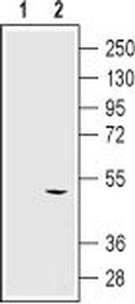 KCNN4 (KCa3.1, SK4) (extracellular) Antibody in Western Blot (WB)