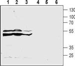 CysLTR2 (extracellular) Antibody in Western Blot (WB)