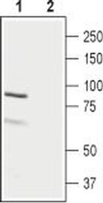 LH Receptor (LHCGR) (extracellular) Antibody in Western Blot (WB)