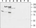 GP130 (extracellular) Antibody in Western Blot (WB)