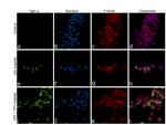 TNF alpha Antibody in Immunocytochemistry (ICC/IF)