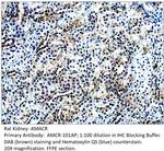 AMACR Antibody in Immunohistochemistry (IHC)