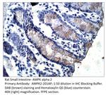 AMPK alpha 2 Antibody in Immunohistochemistry (IHC)