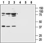 MC1 Receptor Antibody in Western Blot (WB)