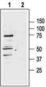 MC1 Receptor Antibody in Western Blot (WB)