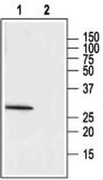 MC2 Receptor (extracellular) Antibody in Western Blot (WB)