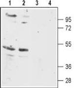 MC5 Receptor Antibody in Western Blot (WB)