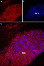 Melatonin Receptor 1A (MTNR1A) Antibody in Immunohistochemistry (IHC)