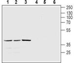 Melatonin Receptor 1A (MTNR1A) Antibody in Western Blot (WB)