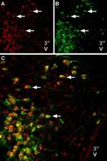 Melatonin Receptor 1B (MTNR1B) Antibody in Immunohistochemistry (Frozen) (IHC (F))