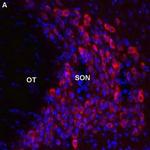 Melatonin Receptor 1B (MTNR1B) Antibody in Immunohistochemistry (Frozen) (IHC (F))