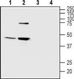 Melatonin Receptor 1B (MTNR1B) Antibody in Western Blot (WB)