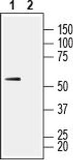 MCT1 (SLC16A1) (extracellular) Antibody in Western Blot (WB)