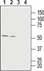 MCT1 (SLC16A1) (extracellular) Antibody in Western Blot (WB)