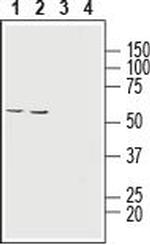 MCT1 (SLC16A1) (extracellular) Antibody in Western Blot (WB)