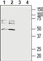 MCT4 (SLC16A3) Antibody in Western Blot (WB)