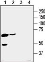 MCT4 (SLC16A3) Antibody in Western Blot (WB)