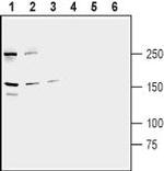 ABCB1/MDR1 Antibody in Western Blot (WB)