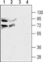 Nicotinic Acetylcholine Receptor alpha 4 (CHRNA4) (extracellular) Antibody in Western Blot (WB)