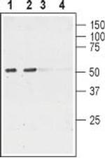 Nicotinic Acetylcholine Receptor alpha 6 (CHRNA6) (extracellular) Antibody in Western Blot (WB)