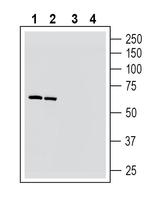 Nicotinic Acetylcholine Receptor alpha 6 (CHRNA6) (extracellular) Antibody in Western Blot (WB)