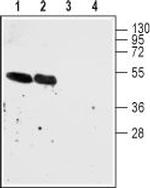 Nicotinic Acetylcholine Receptor alpha 7 (CHRNA7) (extracellular) Antibody in Western Blot (WB)