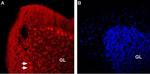 Nicotinic Acetylcholine Receptor beta 2 (CHRNB2) (extracellular) Antibody in Immunohistochemistry (IHC)