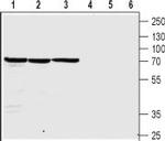 Nicotinic Acetylcholine Receptor beta 4 (CHRNB4) (extracellular) Antibody in Western Blot (WB)