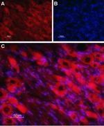 Nicotinic Acetylcholine Receptor beta 4 (CHRNB4) (extracellular) Antibody in Immunohistochemistry (Frozen) (IHC (F))