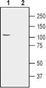 Alpha 2 Na+/K+ ATPase Antibody in Western Blot (WB)