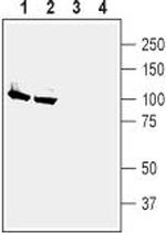 Alpha 2 Na+/K+ ATPase Antibody in Western Blot (WB)